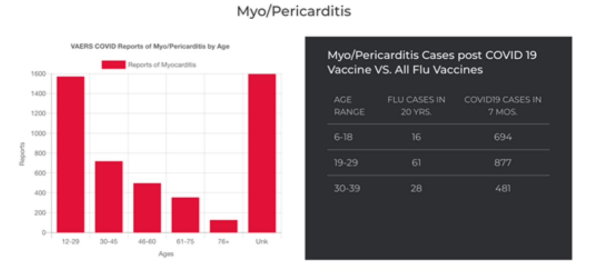 Myopericarditis Byage