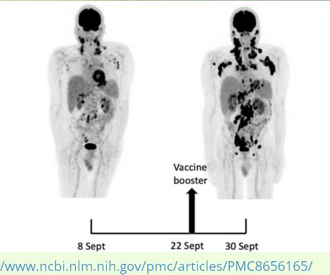 Booster Pubmedpmc8656165 Small