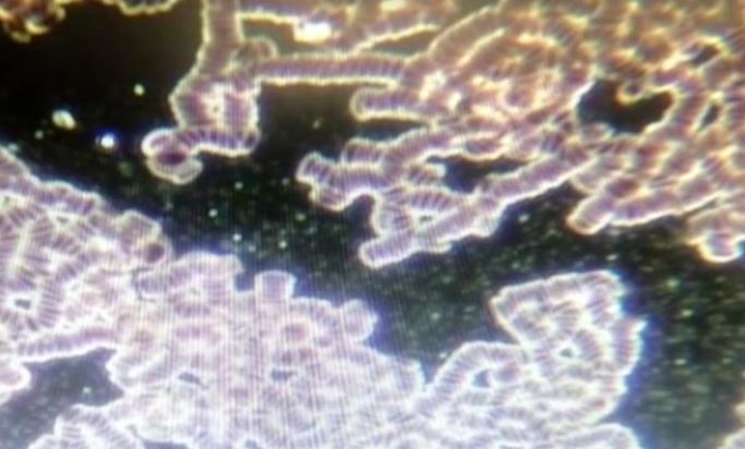 South Africa Zandrebotha Bloodwork Postvax