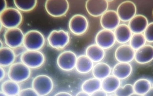 South Africa Zandrebotha Bloodwork Prevax