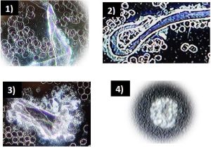 Australia Blood Investigations