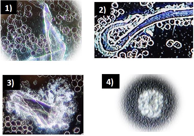 Australia Blood Investigations