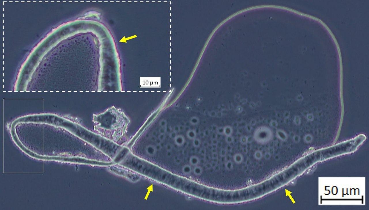Drjohnb Pfizer Microscopy 16