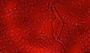 Drphilippe Blood 11 Graphene