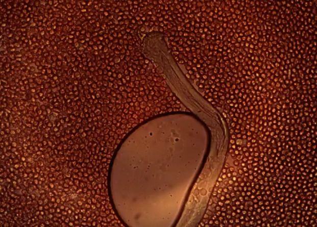 Drphilippe Blood 27 Graphene Tube