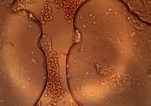 Drphilippe Blood 30 Graphene Cellsget Sucked In