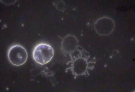 Drrobertyoung 10 Coronaeffect Exosomes3