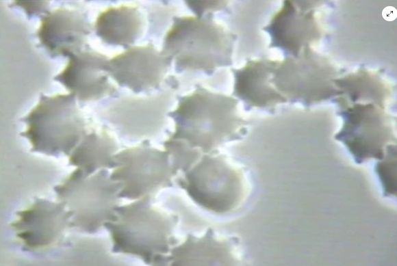 Drrobertyoung 9 Coronaeffect Exosomes2