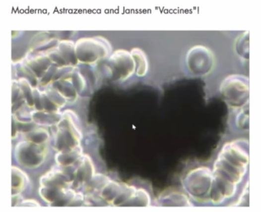 Young Moderna Az Janssen Vaccines Graphene