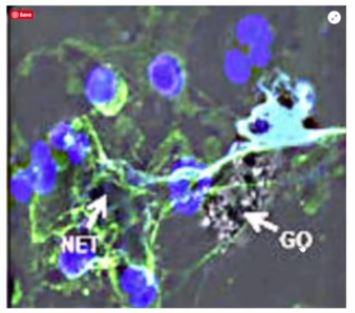 Young Neutrophil Intoxicated By Graphene Oxide