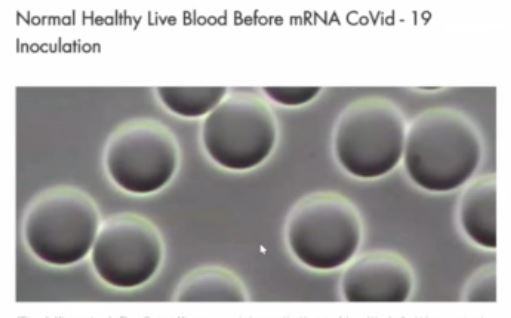 Young Normal Healthy Red Blood Cells
