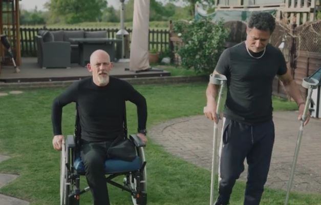 Alexmitchell Now Amputee