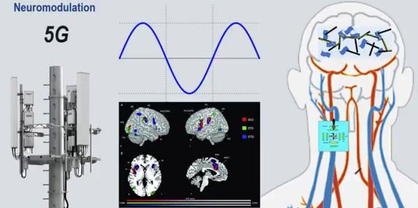 Mikandersen Neuromodulation 5g