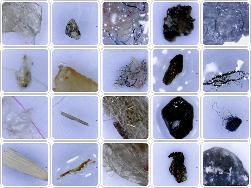 Anti Nano Spain Morgellons